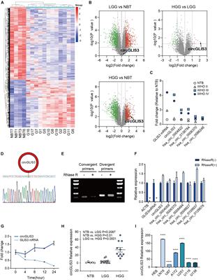 CircGLIS3 Promotes High-Grade Glioma Invasion via Modulating Ezrin Phosphorylation